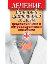 Картинка к книге Рипол-Классик - Лечение болезней щитовидной железы традиционными и нетрадиционными способами