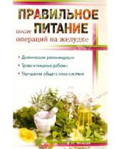 Картинка к книге Игоревич Виктор Немцов - Правильное питание после операции на желудок