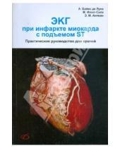 Картинка к книге М. Э. Антман М., Фиол-Сала А., Луна де Байдес - ЭКГ при инфаркте миокарда с подъемом ST